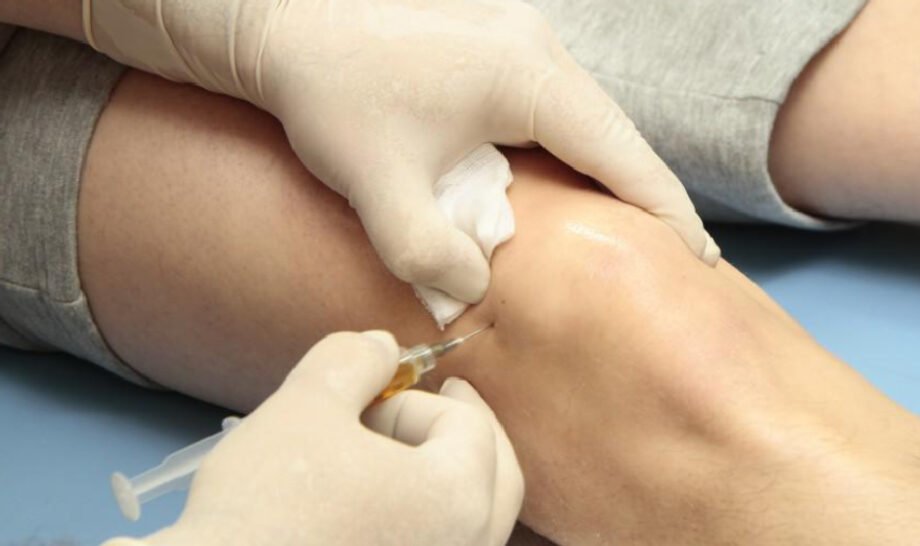 Safety and Side Effects of Prolotherapy and PRP