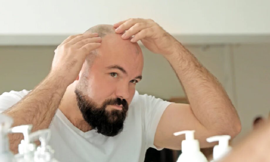 Choosing a Moisturizer for Your Bald Head