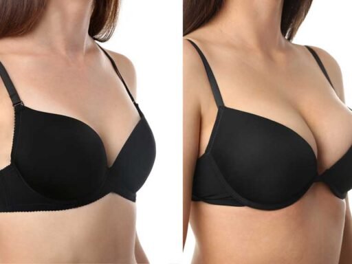 Breast Lift Options: With and Without Augmentation